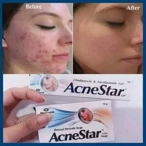 Acne Star Gel (22g)